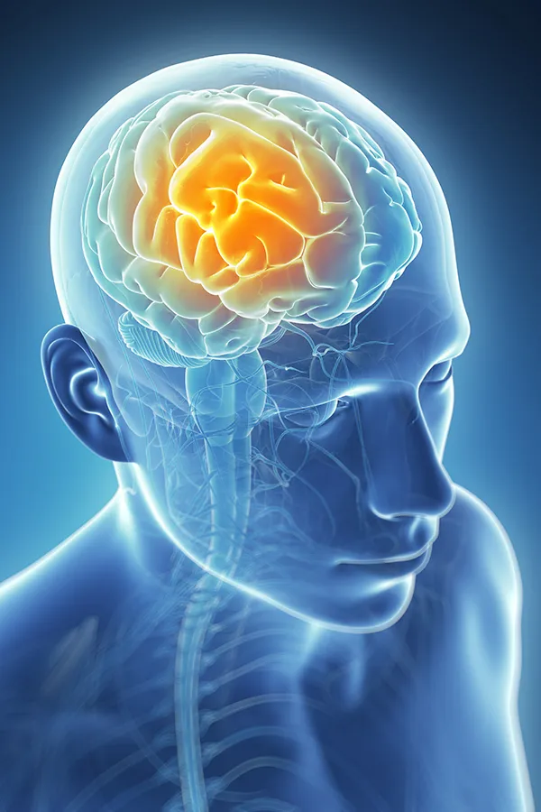 Migraine-Treatment 3D illustration of the brain with glowing pain center. Frank Lanzisera, D.C. treats migraines using functional medicine in Tampa Bay Metro.