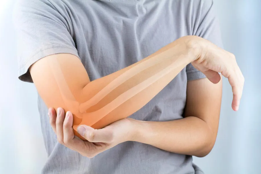 Osteoporosis-Doctor A close-up of a woman holding her elbow with an illustration of the bones and joint experiencing pain from osteoporosis. Get osteoporosis treatment from Frank Lanzisera, D.C. in Tampa Bay Metro.
