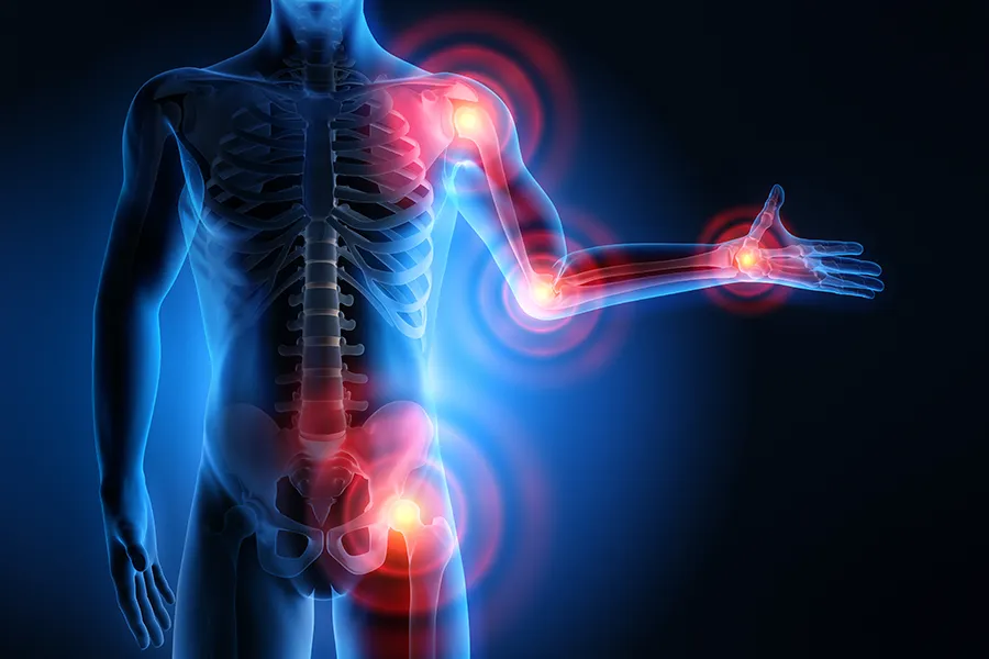 Regenerative-Medicine-for-Joint-Pain-Clinic 3D illustration of a human body under x-ray, with highlights on the joints. Get regenerative medicine for joint pain from Frank Lanzisera, D.C. in Tampa Bay Metro.
